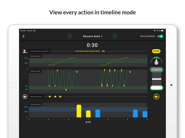 QCPR SkillReporter By Laerdal Medical AS