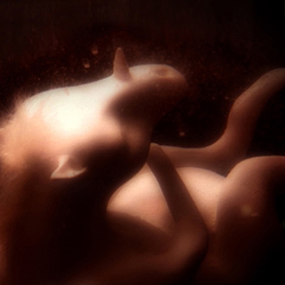 Cover artwork for Young Tender Hearts Beat Fast