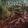 Skinned - Isolating the Gene