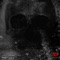 Anxiety - Carlo Ciferni lyrics