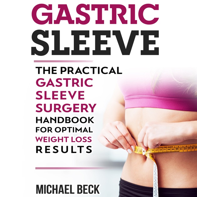 Gastric Sleeve: The