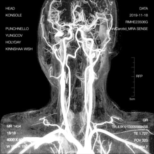 Konsole – Head – EP