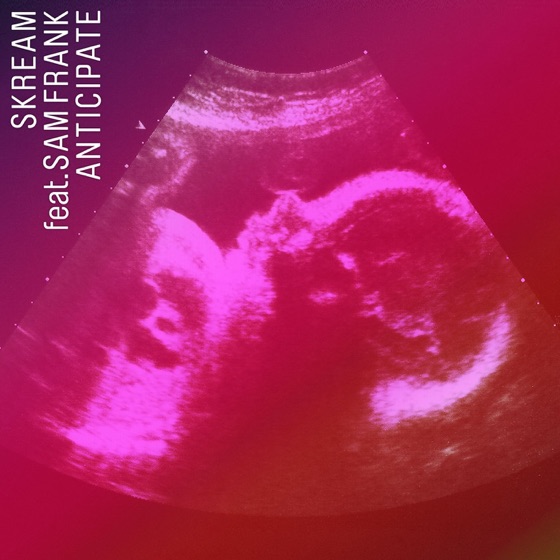 Cover artwork for Anticipate (feat. Sam Frank)