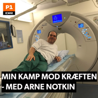 Min kamp mod kræften - med Arne Notkin