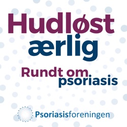 4. Fra Gentofte Hospital 1:3 - Hvad er Psoriasis?