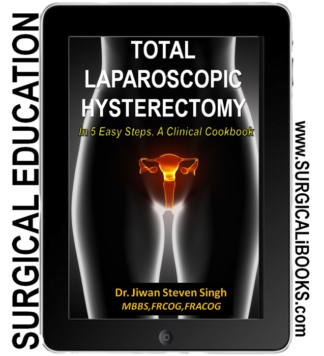 Total Laparoscopic Hysterectomy In 5 Easy Steps