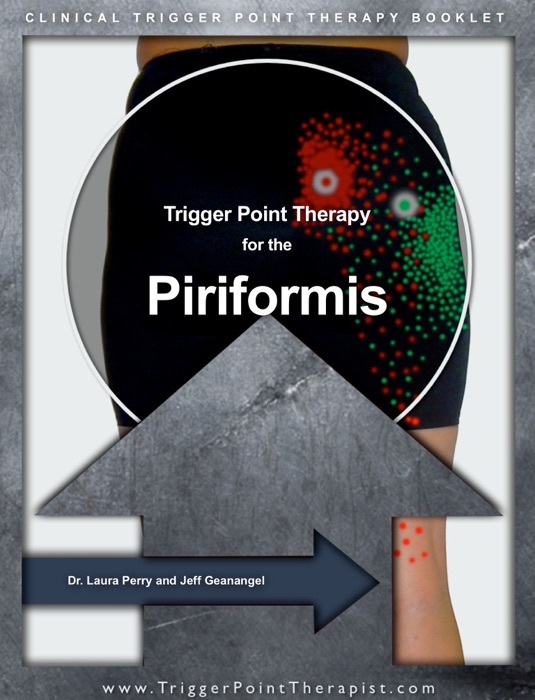 Trigger Point Therapy for the Piriformis