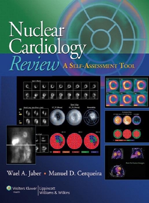 Nuclear Cardiology Review