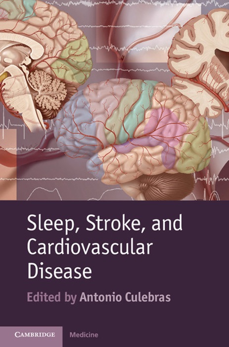 Sleep, Stroke and Cardiovascular Disease