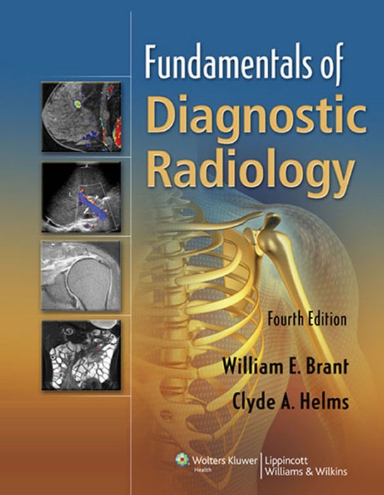 Fundamentals of Diagnostic Radiology: Fourth Edition