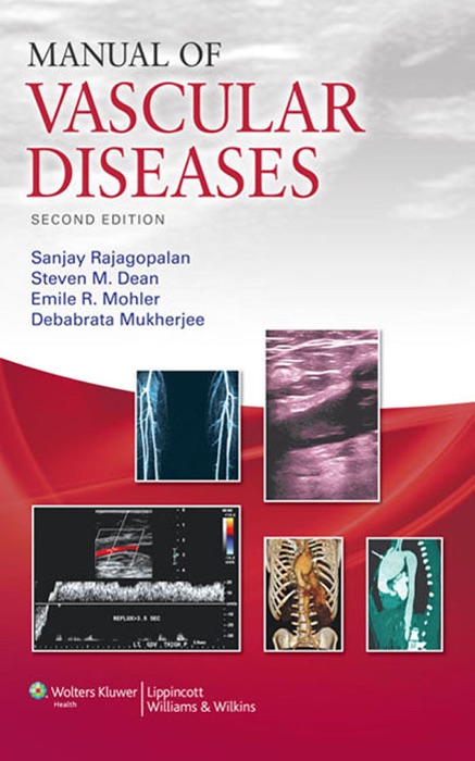 Manual of Vascular Diseases: Second Edition