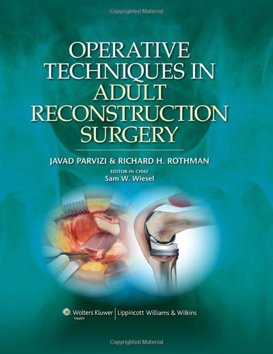 Operative Techniques in Adult Reconstruction Surgery