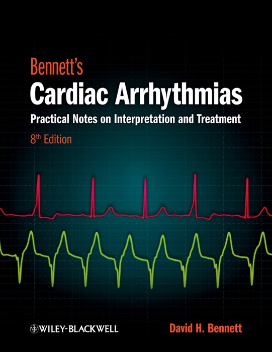 Bennett's Cardiac Arrhythmias