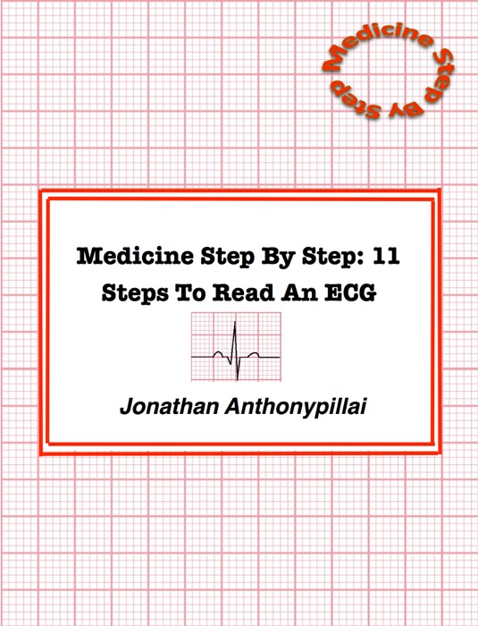 Medicine Step By Step: 11 Steps To Read An Ecg