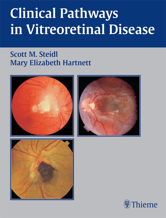 Clinical Pathways in Vitreoretinal Disease