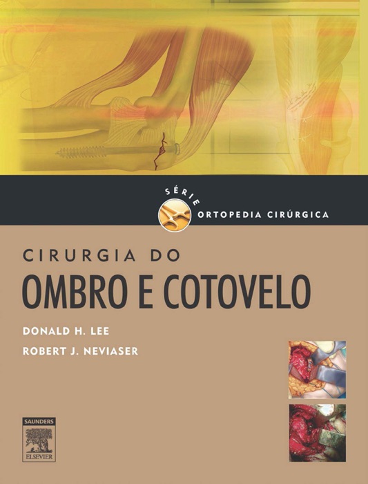 Cirurgia do ombro e cotovelo série de ortopedia cirúrgica