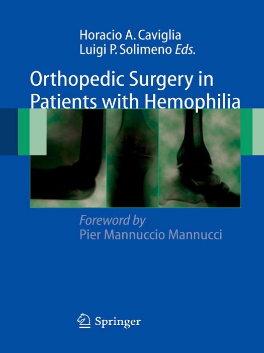Orthopedic Surgery in Patients with Hemophilia
