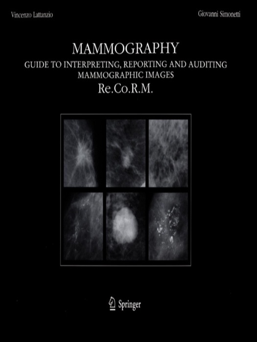 Mammography