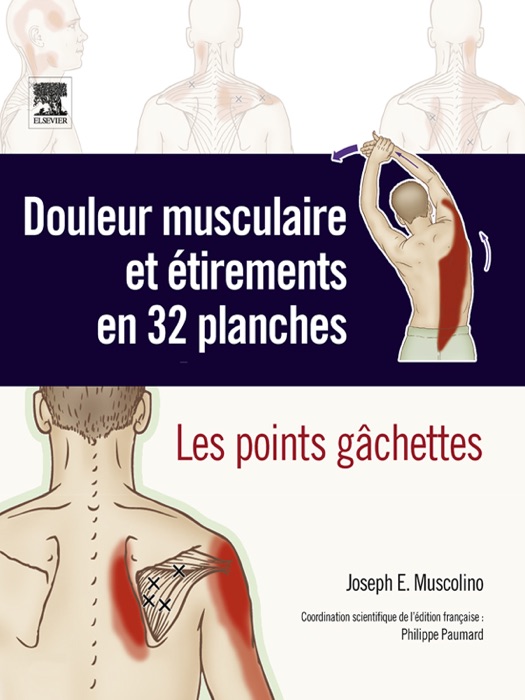 Douleur musculaire et étirements en 32 planches