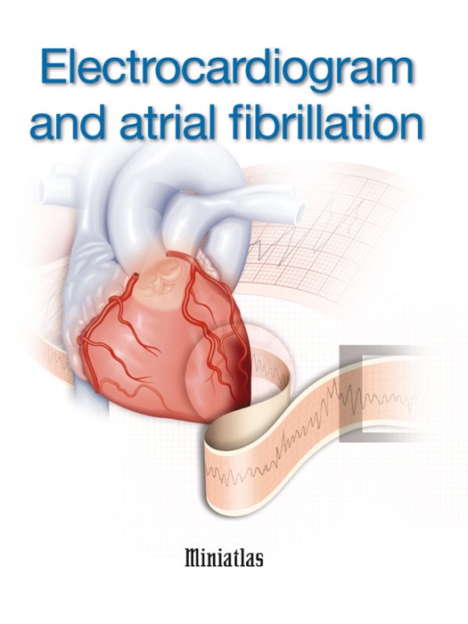 Electrocardiogram and Atrial Fibrillation Miniatlas