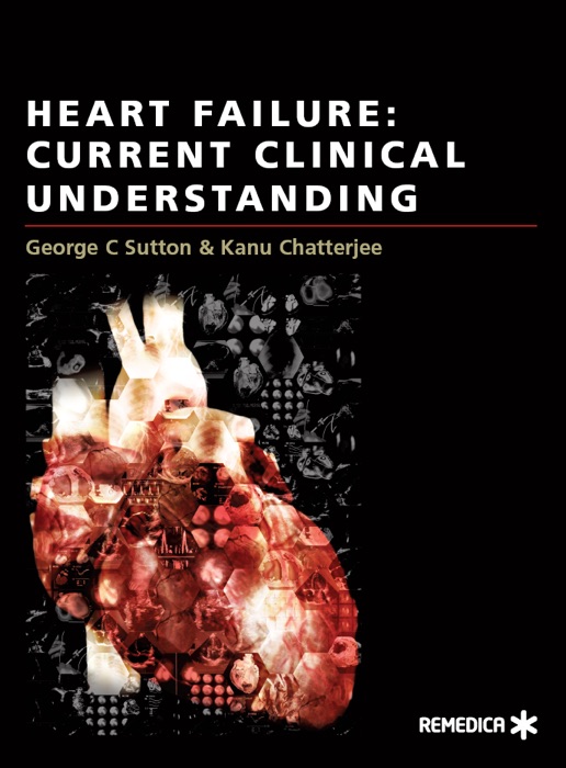 Heart Failure: Current Clinical Understanding