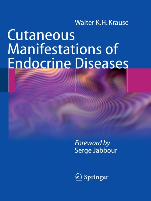 Cutaneous Manifestations of Endocrine Diseases