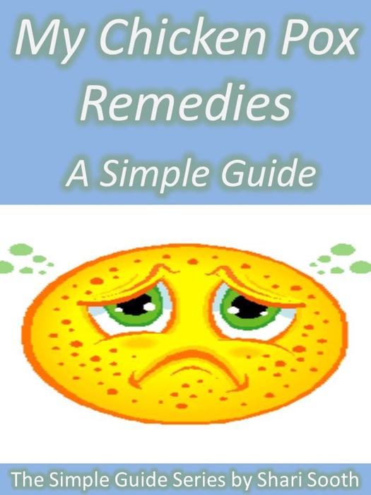 My Chicken Pox Remedies : A Simple Guide