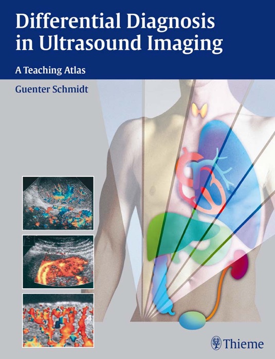 Differential Diagnosis in Ultrasound Imaging