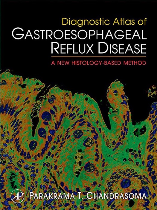 Diagnostic Atlas of Gastroesophageal Reflux Disease (Enhanced Edition)