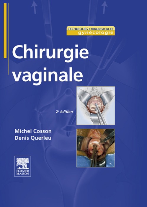 Chirurgie vaginale