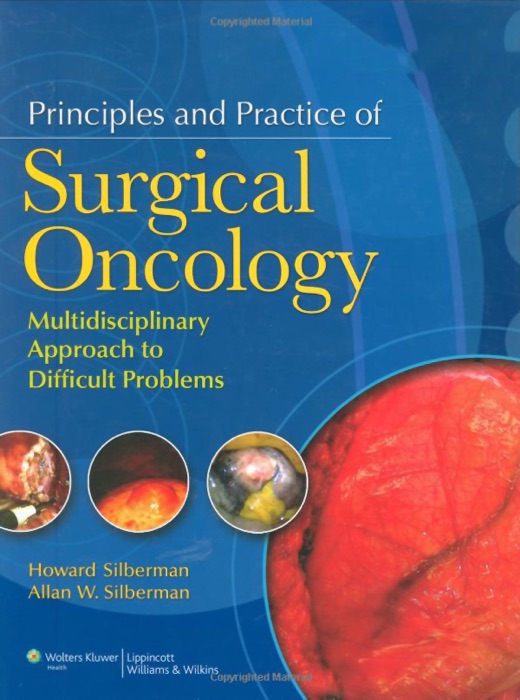 Principles and Practice of Surgical Oncology