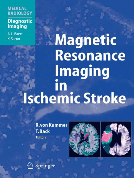 Magnetic Resonance Imaging in Ischemic Stroke