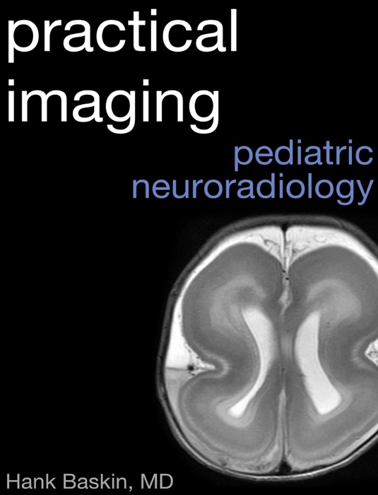 Practical Pediatric Neuroradiology