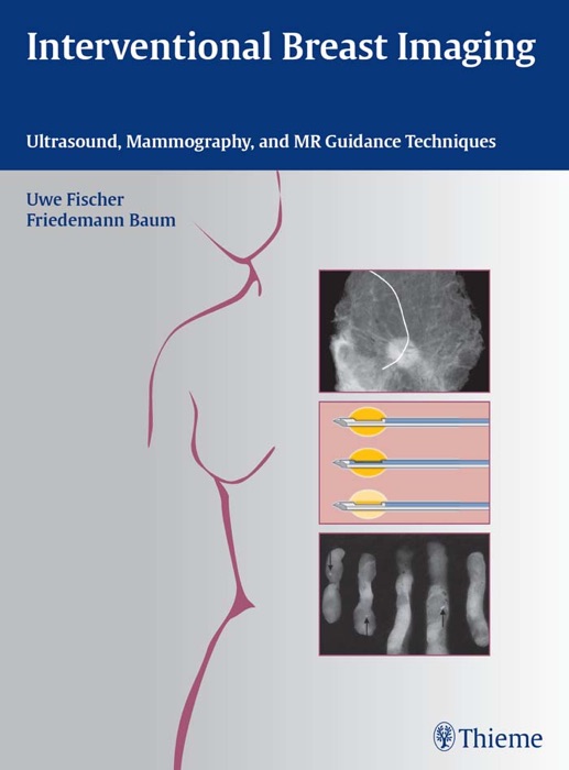 Interventional Breast Imaging