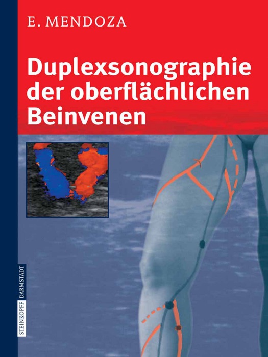 Duplexsonographie der oberflächlichen Beinvenen