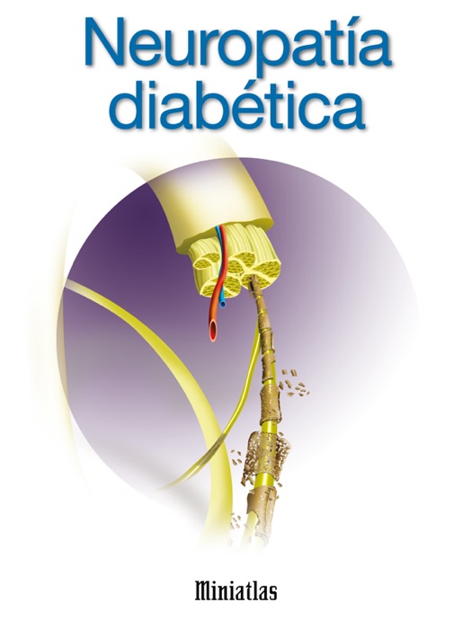 Miniatlas: Neuropatía diabética