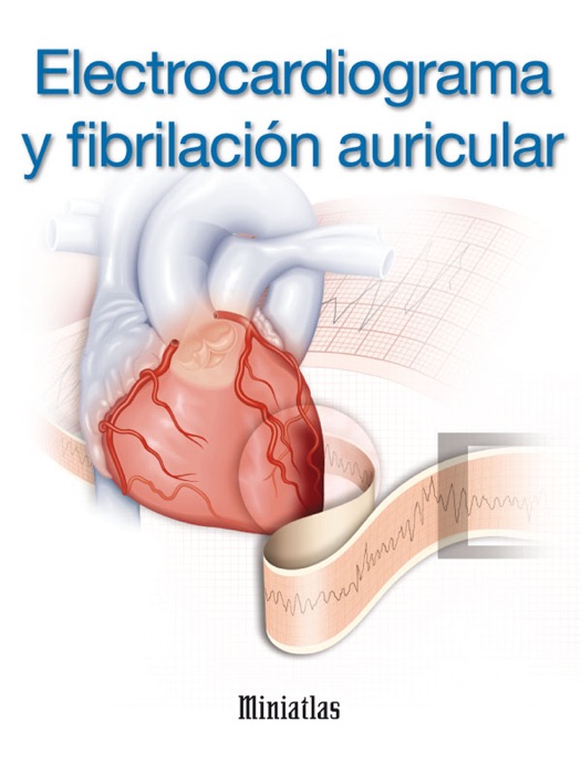 Miniatlas: Electrocardiograma y fibrilación auricular