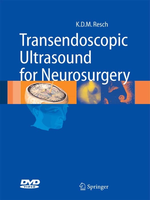 Transendoscopic Ultrasound for Neurosurgery