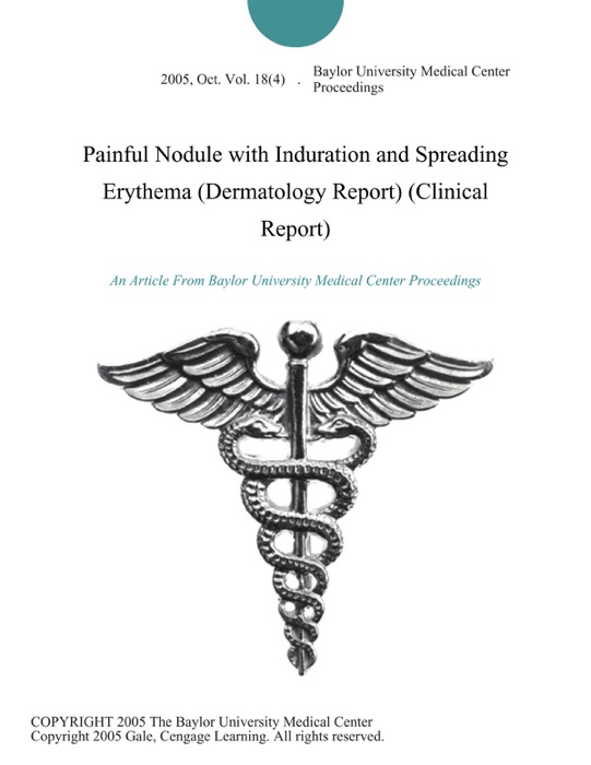 Painful Nodule with Induration and Spreading Erythema (Dermatology Report) (Clinical Report)