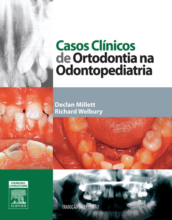 Casos Clínicos de Ortodontia na Odontopediatria