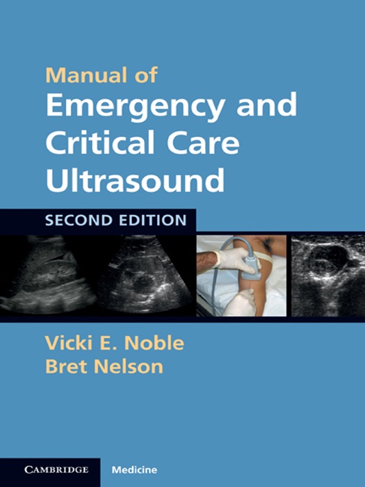 Manual of Emergency and Critical Care Ultrasound: Second Edition