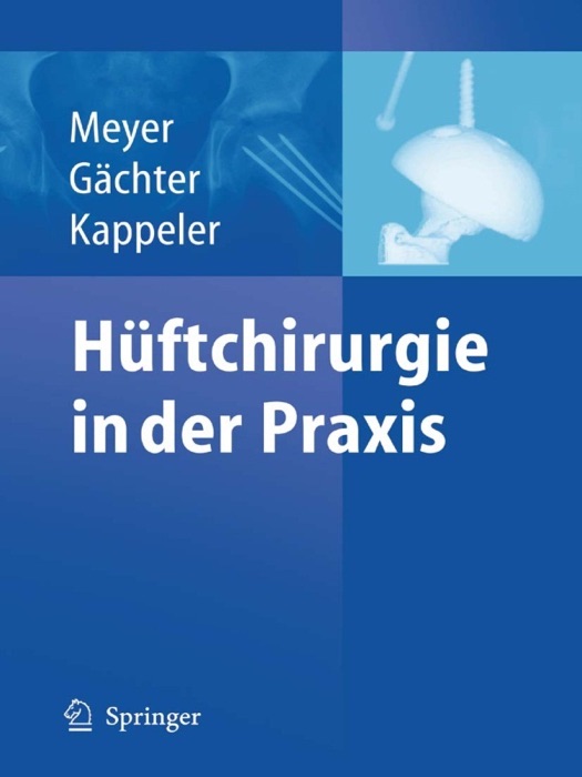 Hüftchirurgie in der Praxis