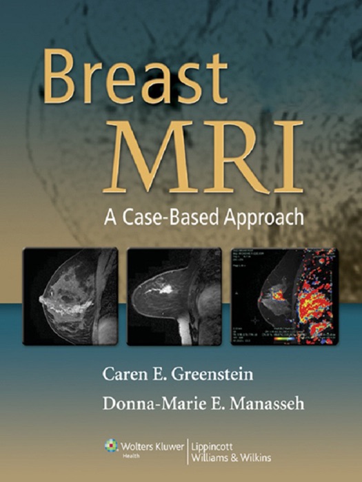 Breast MRI