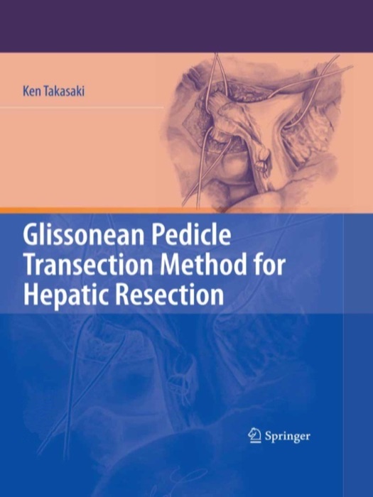 Glissonean Pedicle Transection Method for Hepatic Resection