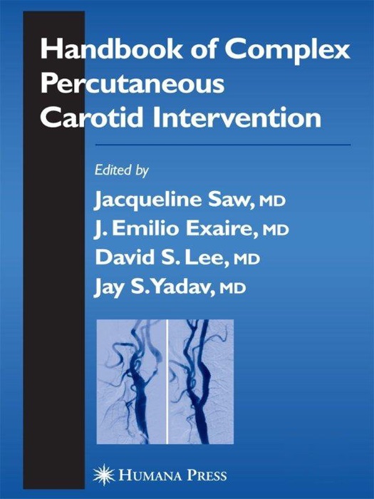 Handbook of Complex Percutaneous Carotid Intervention