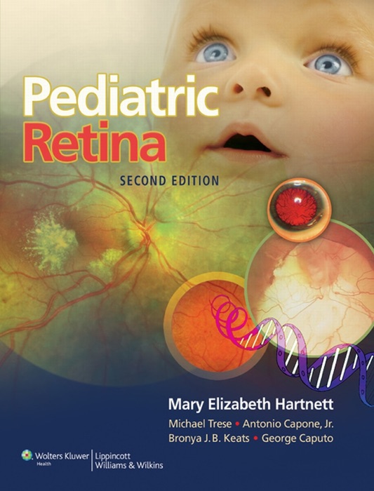 Pediatric Retina: Second Edition