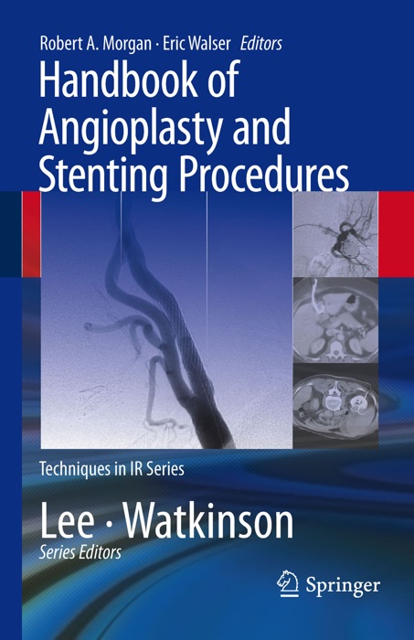 Handbook of Angioplasty and Stenting Procedures