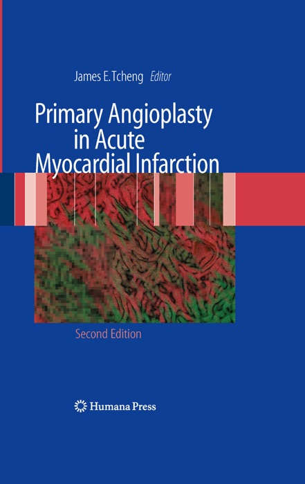 Primary Angioplasty in Acute Myocardial Infarction