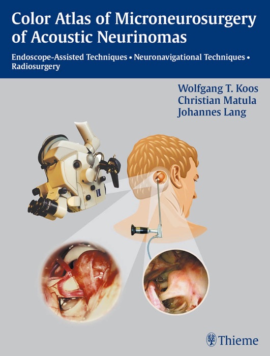 Color Atlas of Microneurosurgery of Acoustic Neurinomas