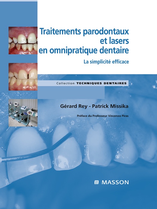 Traitements parodontaux et lasers en omnipratique dentaire